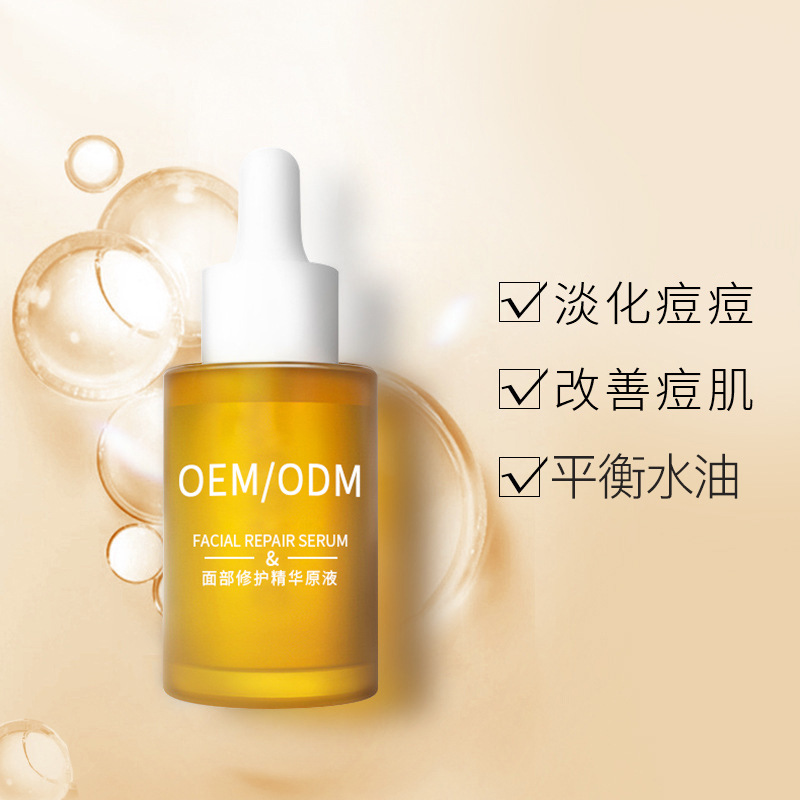 德州市_祛痘精华原液OEM